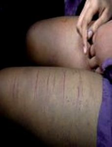 images_cms-image-000028262