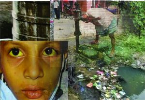 Jaundice-Cuttack