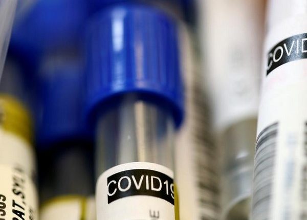 Odisha Coronavirus COVID19 Tests Record